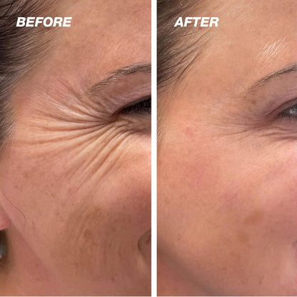 Rovinao™ The Vita A Retinal Shot Tightening Booster